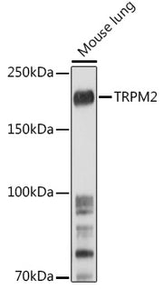 TRPM2 Rabbit pAb