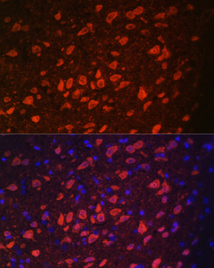 TRPM2 Rabbit pAb