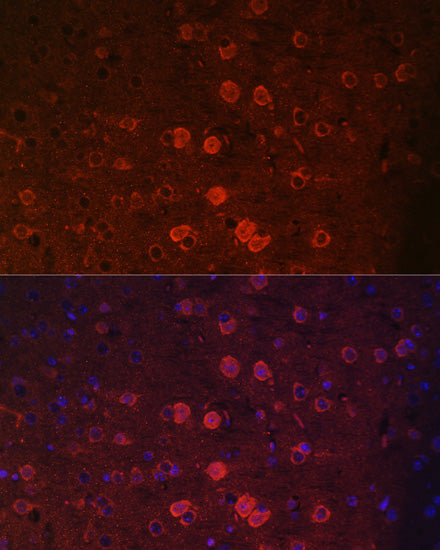 TRPM2 Rabbit pAb