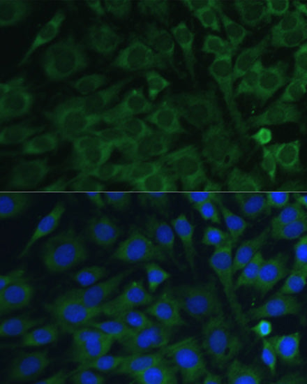 Oncostatin M Rabbit pAb