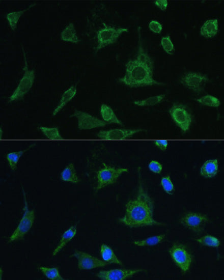 Oncostatin M Rabbit pAb