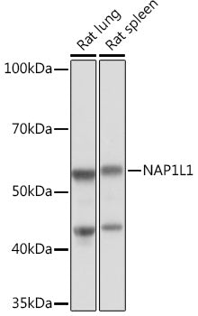 NAP1L1 Rabbit mAb