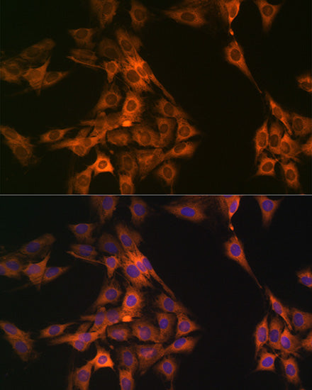 NAP1L1 Rabbit mAb