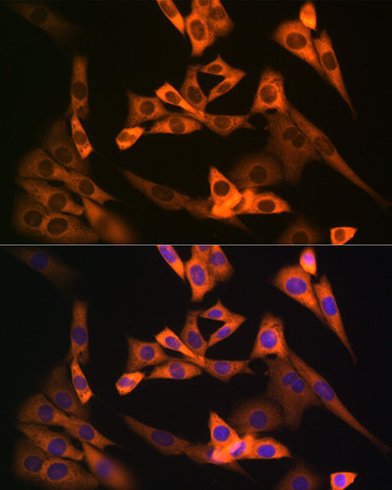 NAP1L1 Rabbit mAb