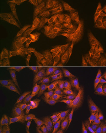 NAP1L1 Rabbit mAb