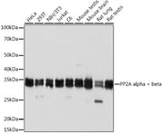 PP2A alpha/beta Rabbit mAb