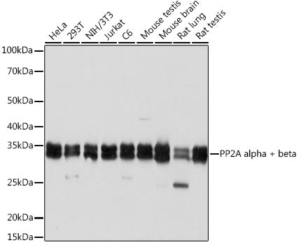 PP2A alpha/beta Rabbit mAb