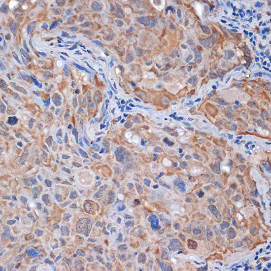 PP2A alpha/beta Rabbit mAb