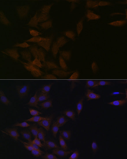 PP2A alpha/beta Rabbit mAb