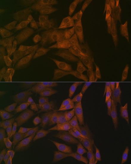 PP2A alpha/beta Rabbit mAb