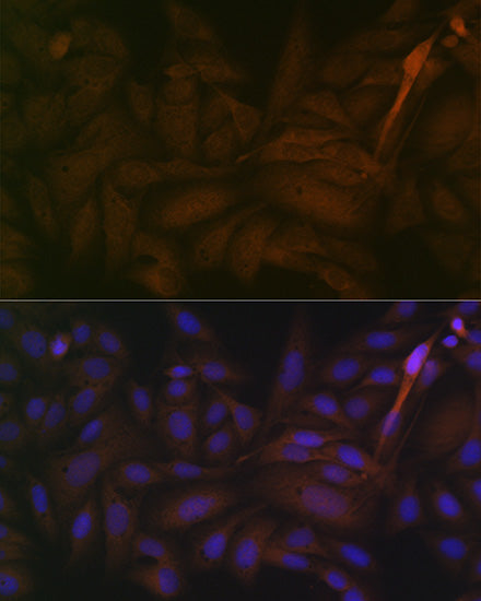 PP2A alpha/beta Rabbit mAb