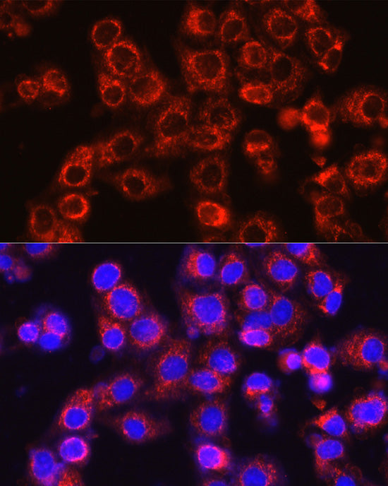 Osteocalcin/OCN Rabbit pAb