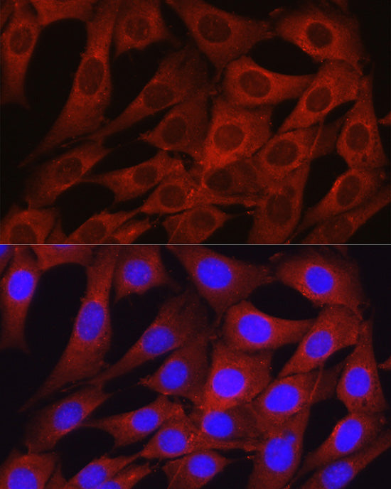 Osteocalcin/OCN Rabbit pAb