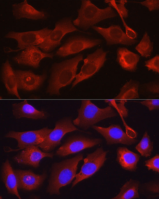 Osteocalcin/OCN Rabbit pAb