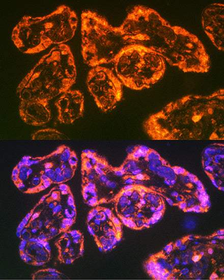 Integrin alpha 5 (ITGA5/CD49e) Rabbit pAb
