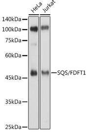 SQS/FDFT1 Rabbit pAb