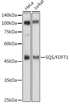 SQS/FDFT1 Rabbit pAb