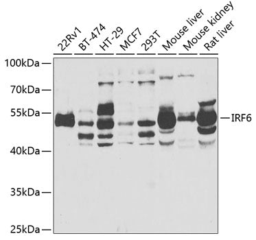 IRF6 Rabbit pAb