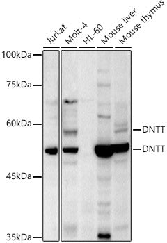 TdT Rabbit pAb