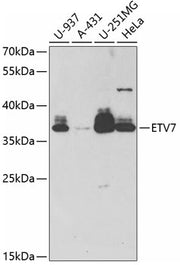 ETV7 Rabbit pAb