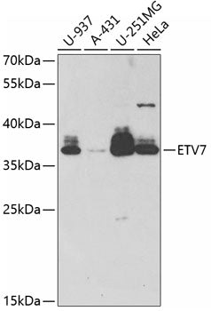 ETV7 Rabbit pAb