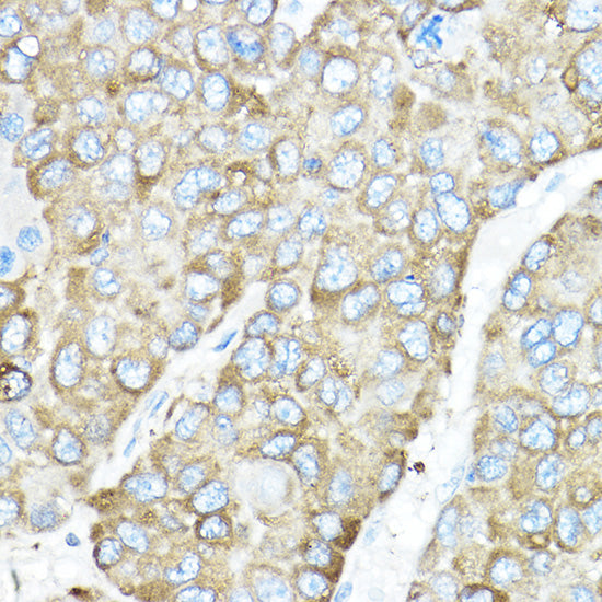 Grp94 Rabbit pAb