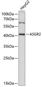 ASGR2 Rabbit pAb