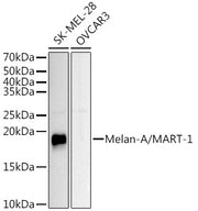 Melan-A/MART-1 Rabbit pAb