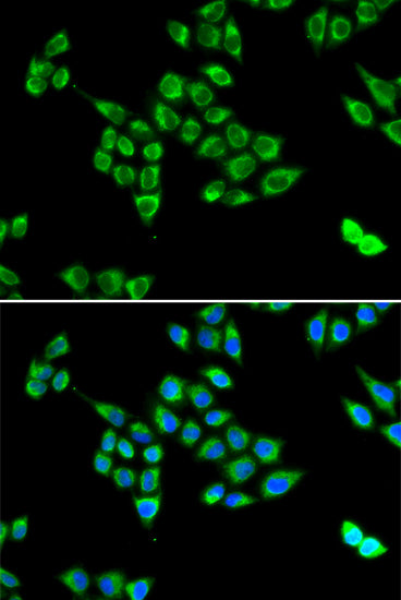 Pyruvate carboxylase (PC) Rabbit pAb