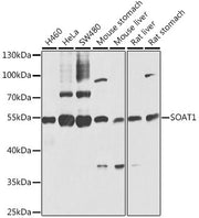 SOAT1 Rabbit pAb