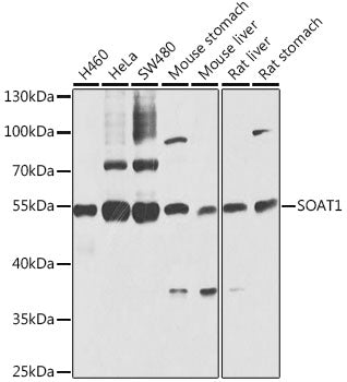 SOAT1 Rabbit pAb