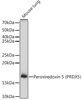 Peroxiredoxin 5 (PRDX5) Rabbit pAb