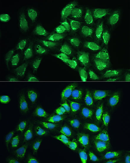 Peroxiredoxin 5 (PRDX5) Rabbit pAb