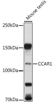 CCAR1 Rabbit pAb