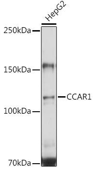 CCAR1 Rabbit pAb