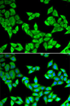 CIAPIN1 Rabbit pAb