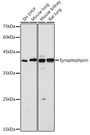 Synaptophysin Rabbit pAb