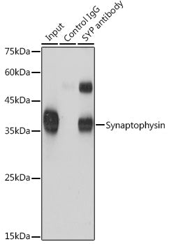 Synaptophysin Rabbit pAb
