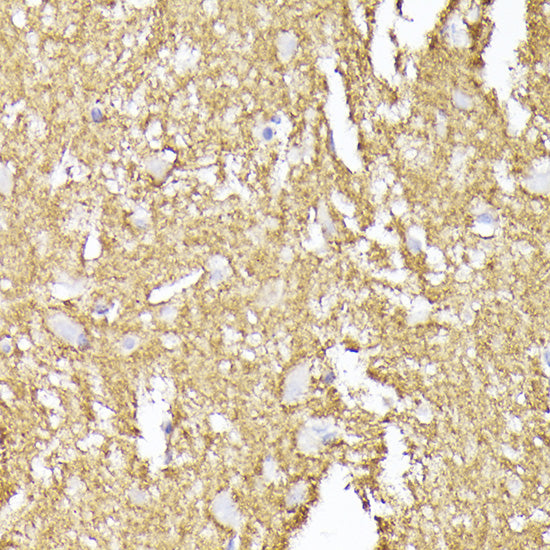 Synaptophysin Rabbit pAb