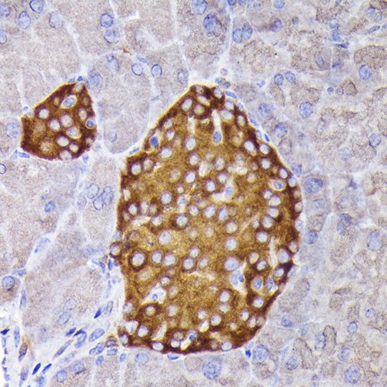 Synaptophysin Rabbit pAb