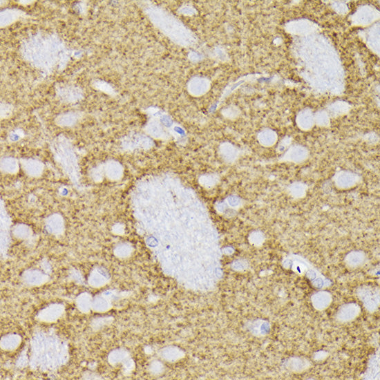 Synaptophysin Rabbit pAb