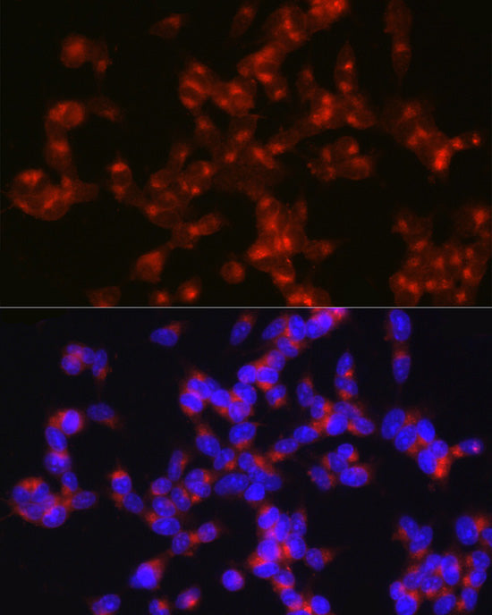 Synaptophysin Rabbit pAb