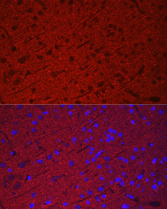 Synaptophysin Rabbit pAb