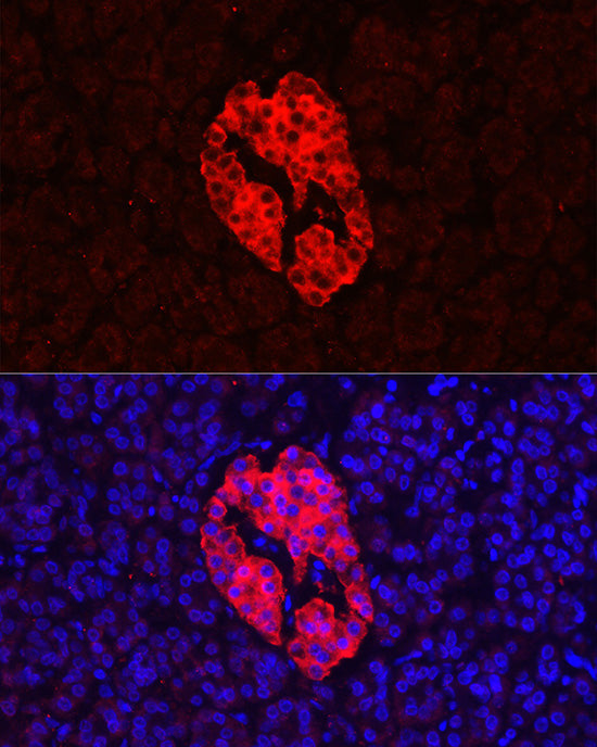 Synaptophysin Rabbit pAb