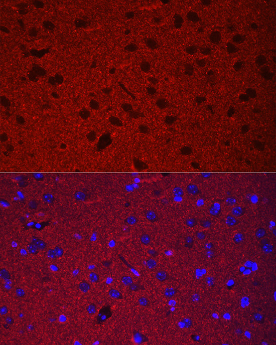Synaptophysin Rabbit pAb