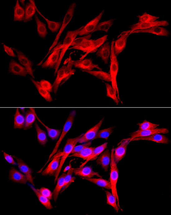 Fibroblast activation protein-α (FAP) Rabbit pAb