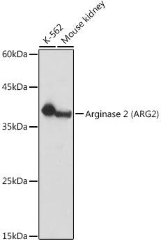 Arginase 2 (ARG2) Rabbit pAb