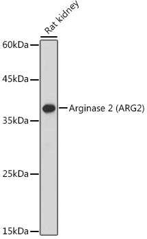 Arginase 2 (ARG2) Rabbit pAb