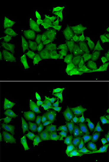 RHOH Rabbit pAb