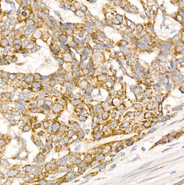 Glycerol kinase (GK) Rabbit pAb